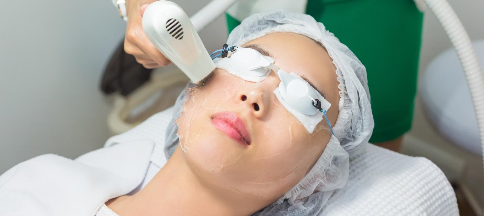 laser pigmentation treatment for skin