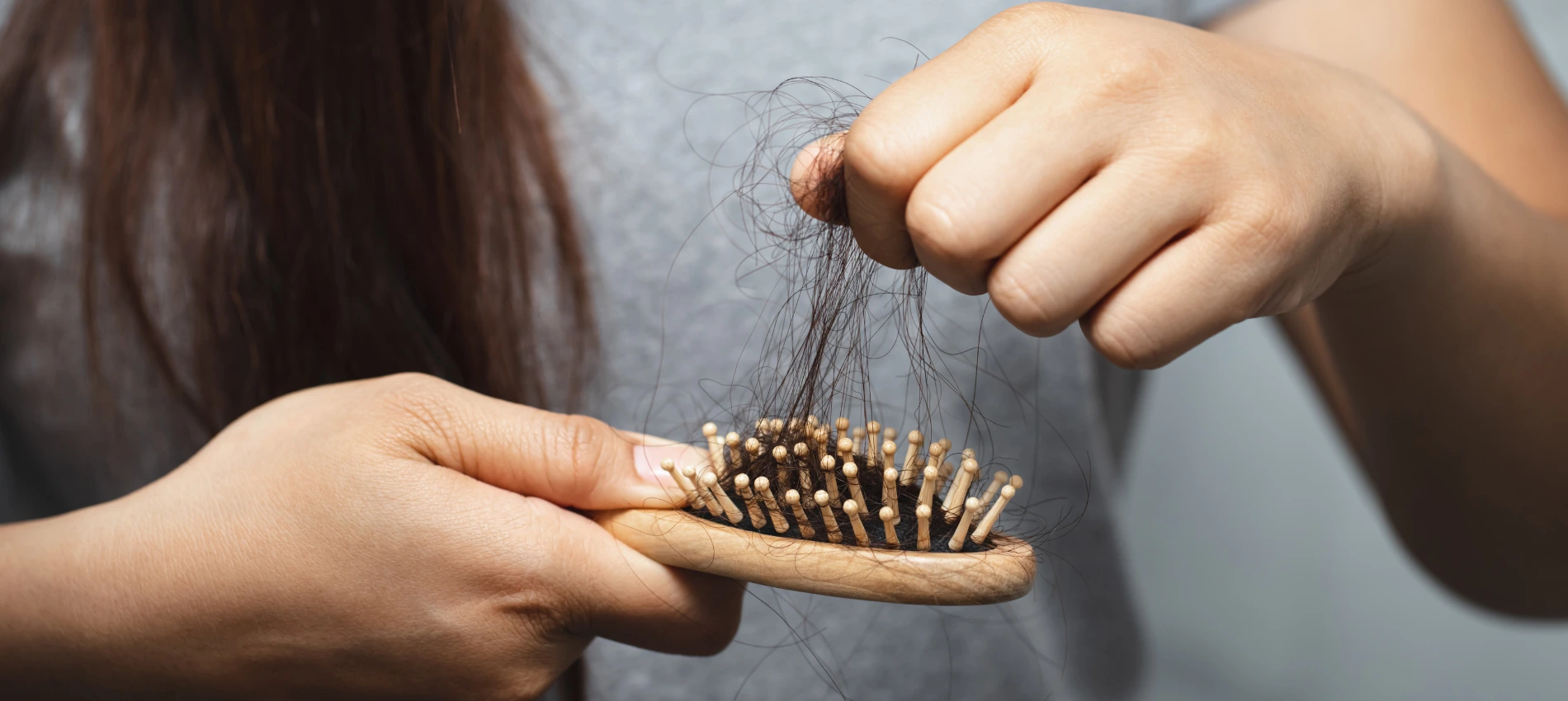 mesotherapy for hair treatment in Dubai