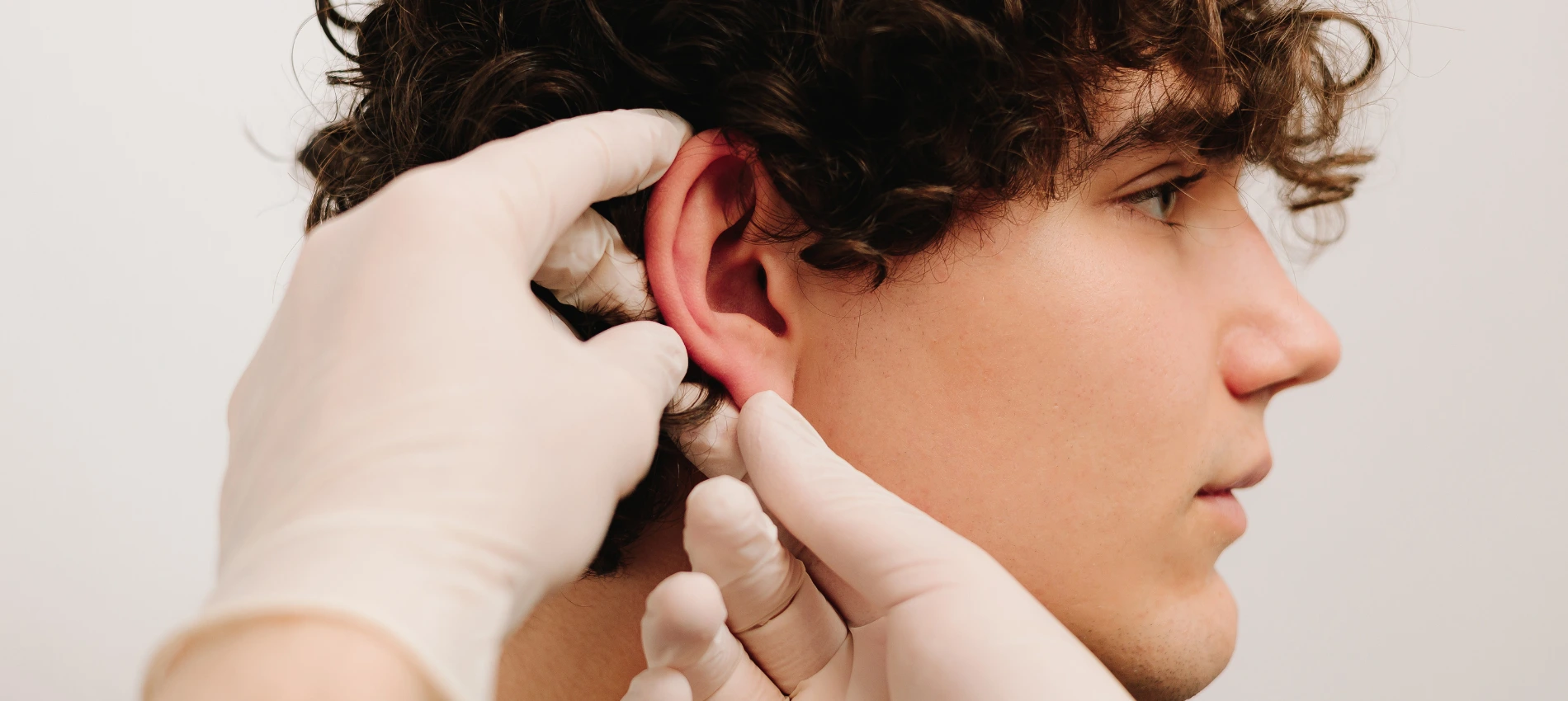 Considering otoplasty surgery in Dubai? Discover expert care with top otoplasty surgeons in Dubai