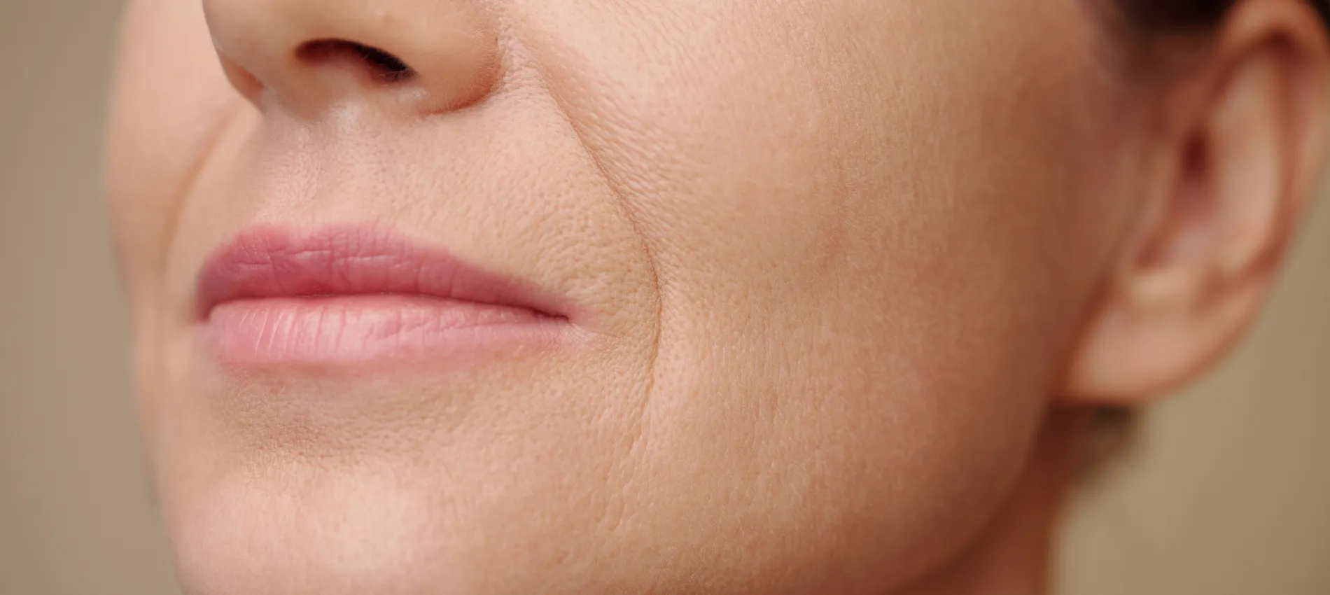 Best Treatments for Nasolabial Folds in Dubai