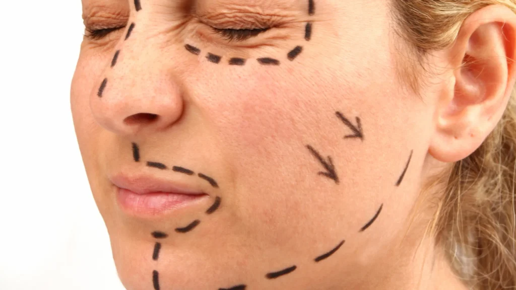 Best face lift in Dubai including surgical face lift and non surgical face lift at Healia Medical Center.