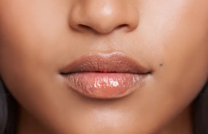 laser lip rejuvenation treatment for fine lines around mouth in dubai near me