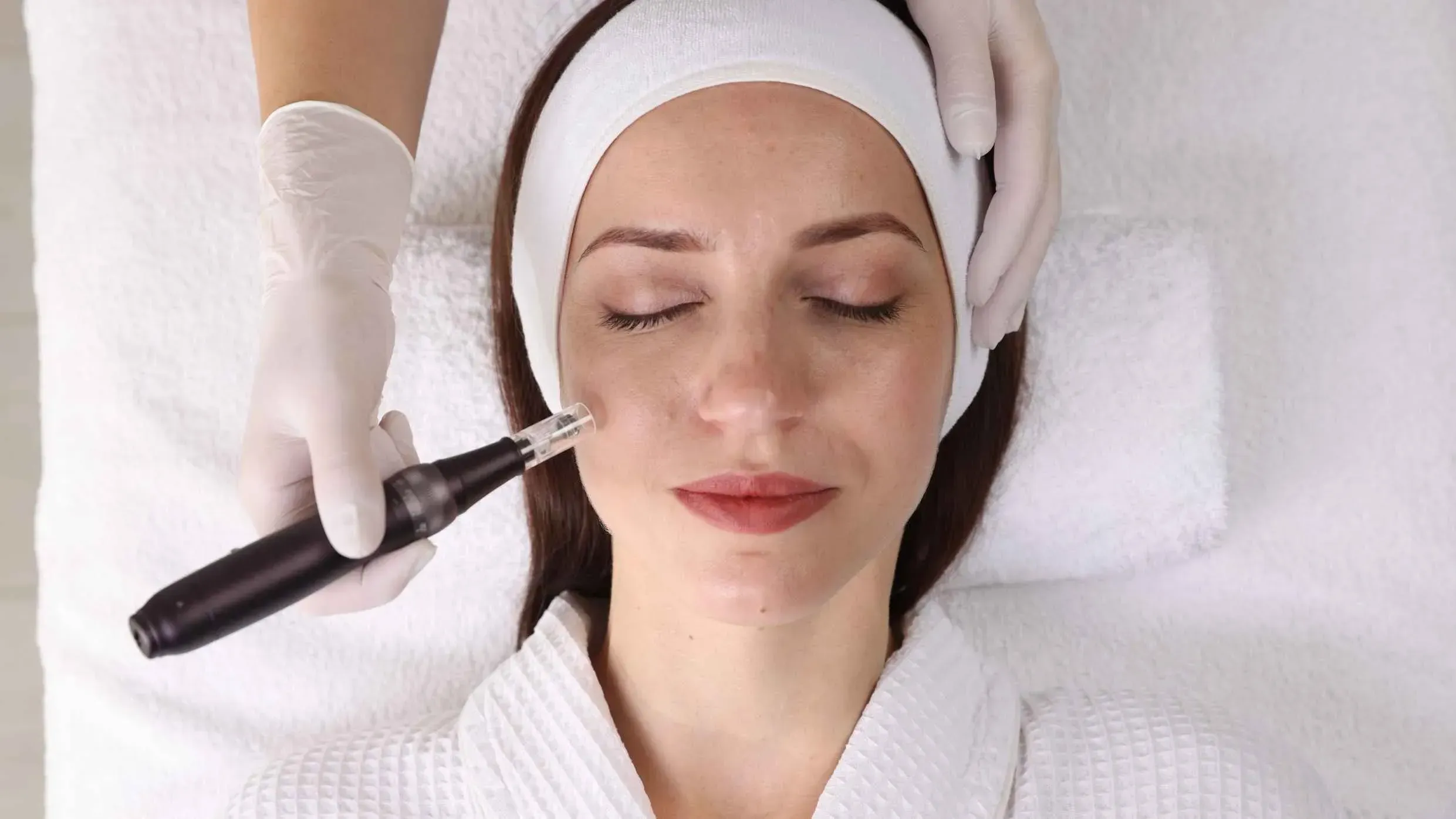 micro needling in dubai