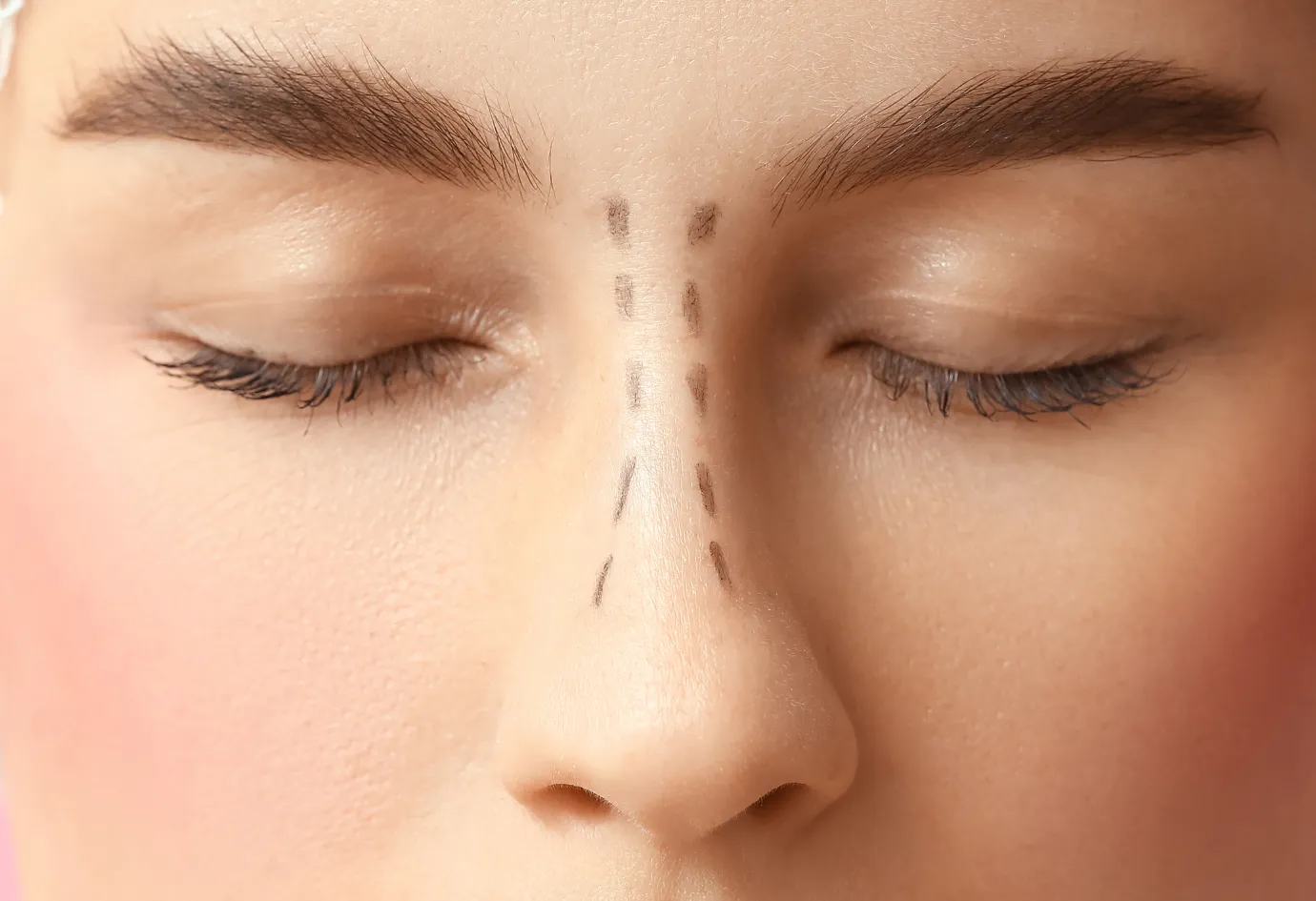 Piezoelectric rhinoplasty at Healia Medical Center Dubai