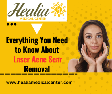 Everything You Need To Know About Laser Acne Scar Removal