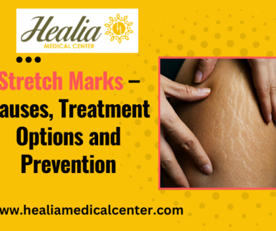 Stretch Marks 1