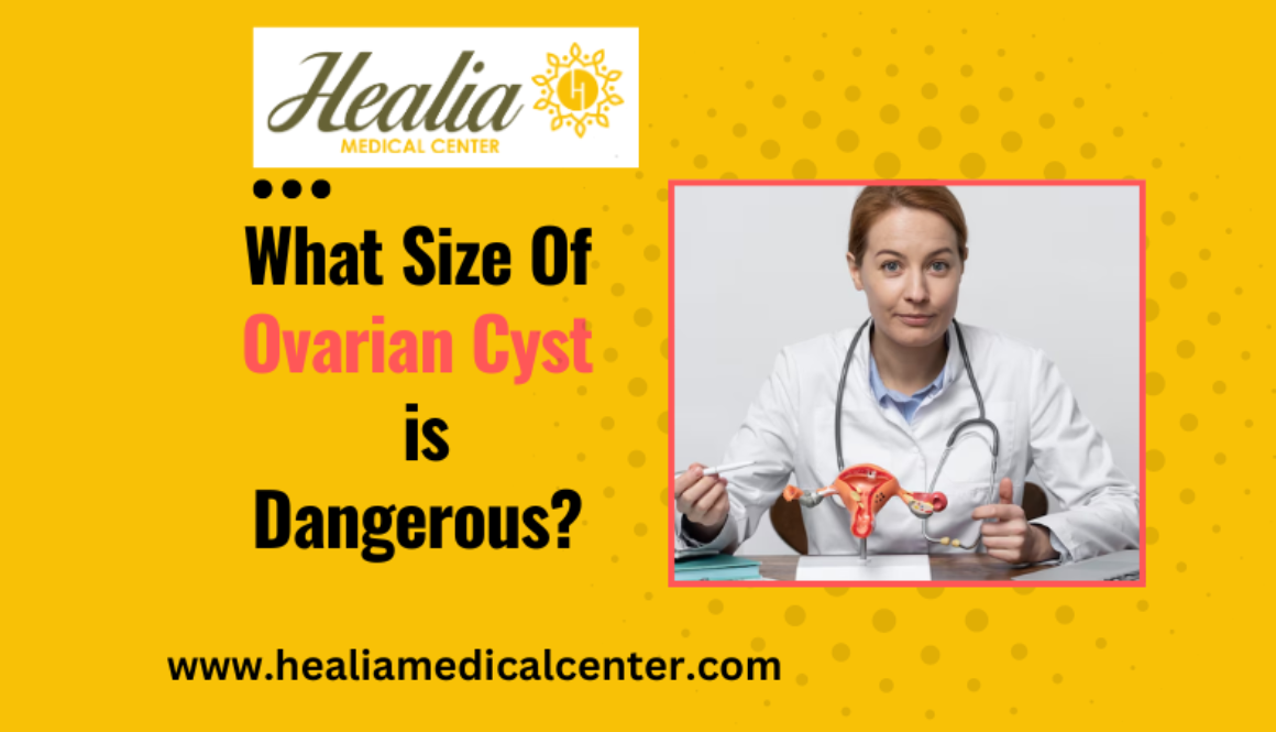 What Size Of Ovarian Cyst Is Dangerous 2