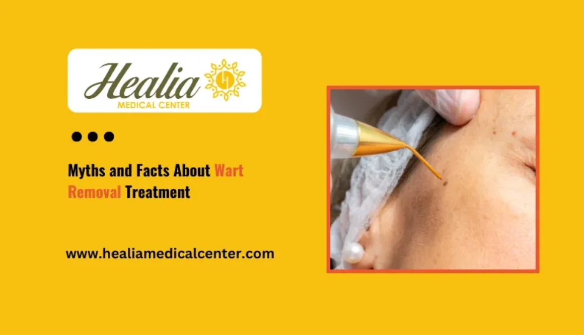 Wart Removal Blog Img 4